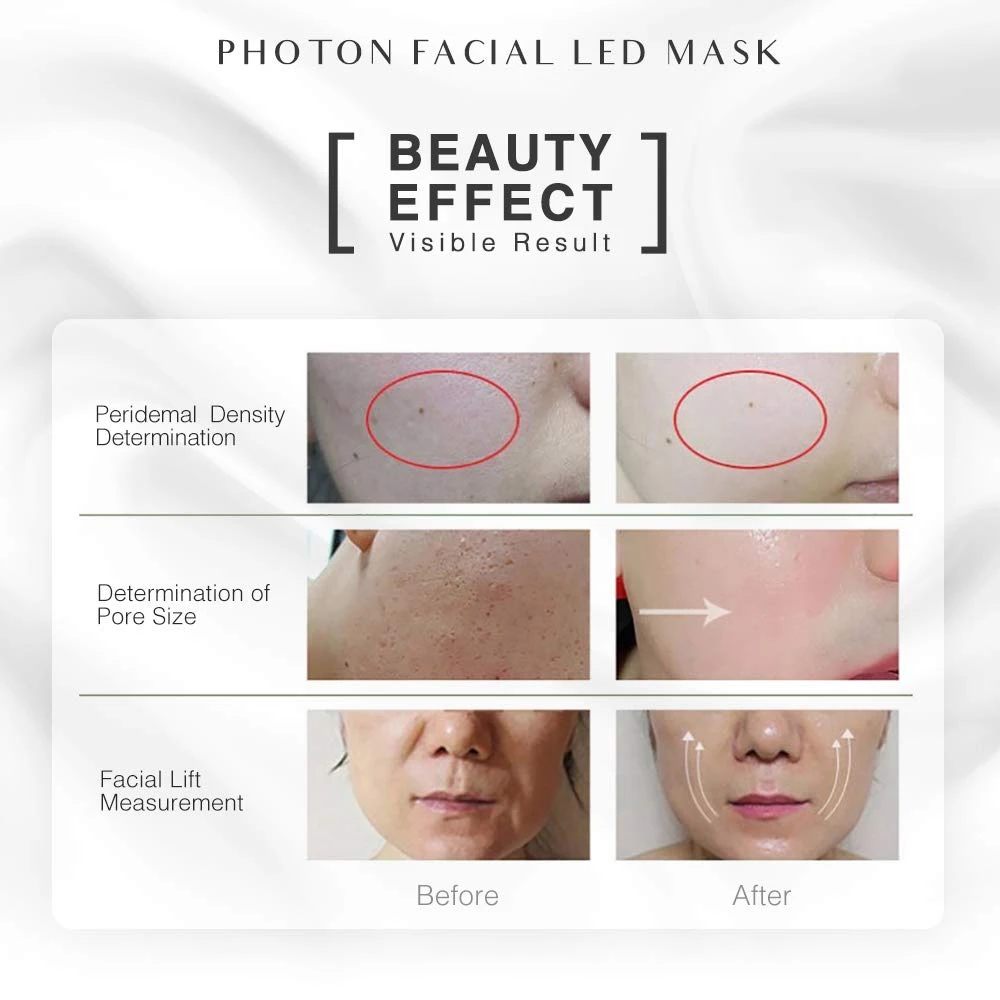 Photon Skin Rejuvenation Instrument Beauty Mask