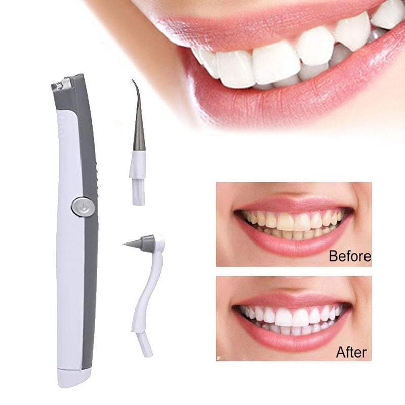 Electric Ultrasonic Tooth Stain Eraser Plaque Remover - Dental Tool