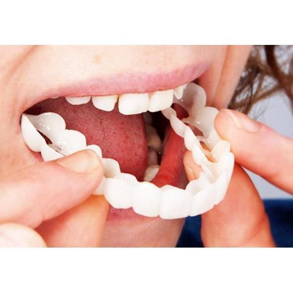 Artificial braces for upper and lower teeth