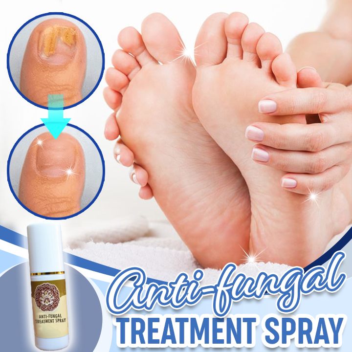 Foot spray foot sweat foot odor care spray foot deodorant dehumidification spray spray